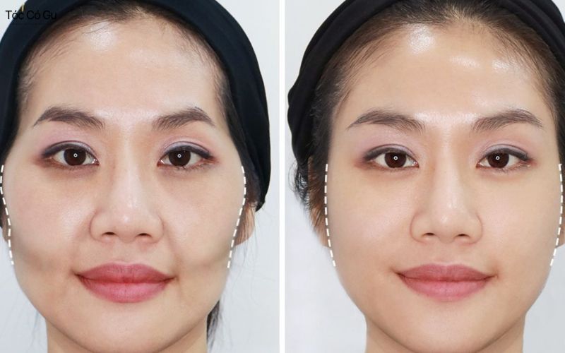 Gò má cao để tóc kiểu gì cho mặt thon gọn, trẻ trung hơn Gò má cao dễ nhận biết khi quan sát gương mặt ở nhiều góc độ