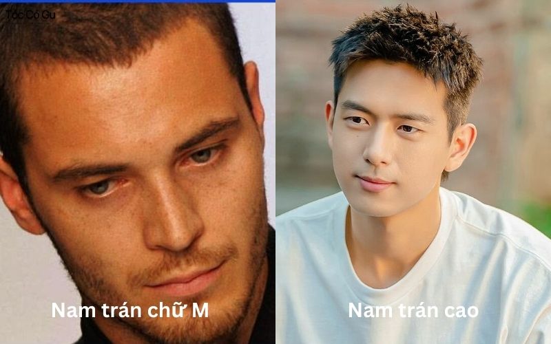 Bí quết chọn kiểu tóc nam trán cao đẹp, che trán hoàn hảo Phân biệt nam trán cao và trán chữ M