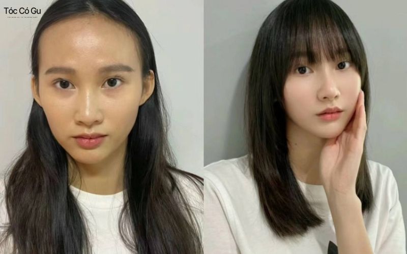 Khuôn mặt trán dô dễ nhận thấy rõ khi quan sát ở góc nghiêng