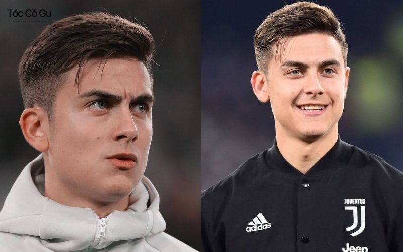 Kiểu tóc sport undercut