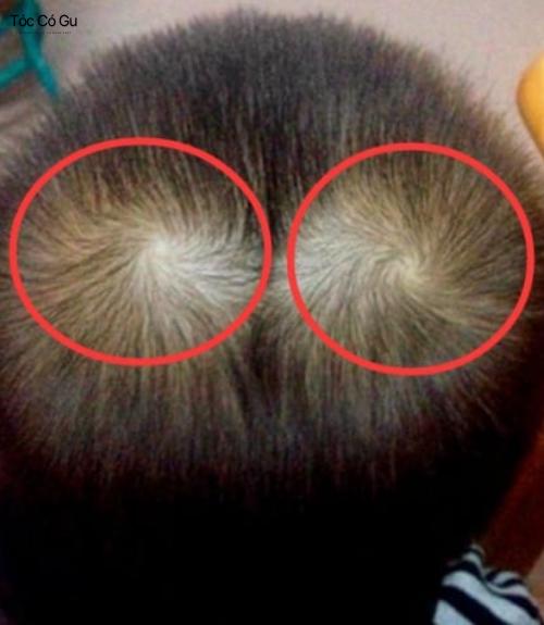 đầu nam 2 xoáy