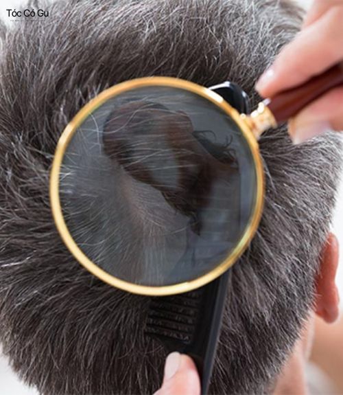 Có nên để sáp vuốt tóc qua đêm? Nó sẽ làm bít tắc lỗ chân lông